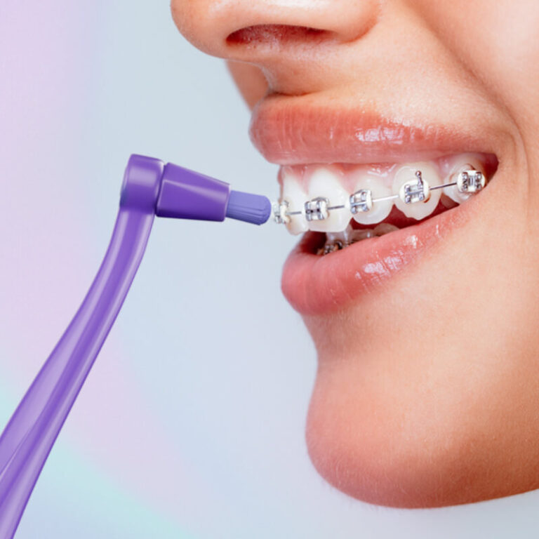 Монопучковая зубная щетка SPLAT SMILEX ORTHO+ со сменными головками ...